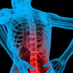 upper back pain treatment