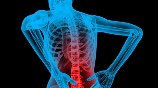 Upper Back Pain Treatment: Causes, Relief, and the Non-Surgical Path to Recovery