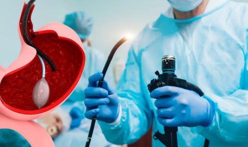 Exploring Gastric Balloons: A Modern Approach to Weight Loss